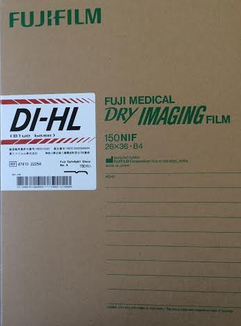 Pellicola RX digitale Fuji DI-HL, cm 26 x 36, confezione da 150 pz