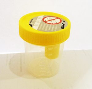 Contenitore per urine graduato 120 ml, tappo a vite con dispositivo per aspirazione con provette sottovuoto